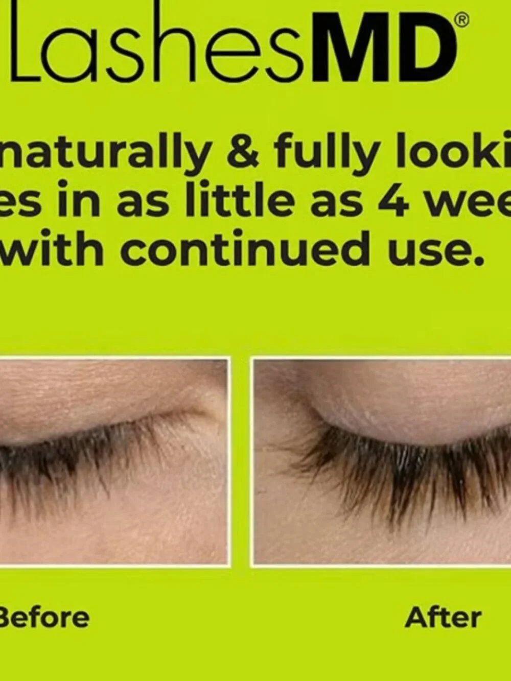 LashesMD Eyelash / Eyebrow Conditioner